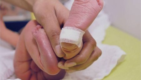 Modülatör ilaçlar SGK kapsamında, Topuk kanı testi kistik fibroziste de hayat kurtarıyor